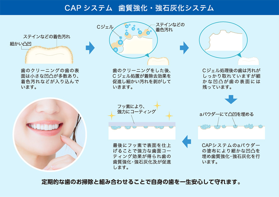 歯科CAPシステムの仕組み